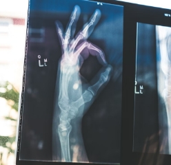 Cone Beam CT