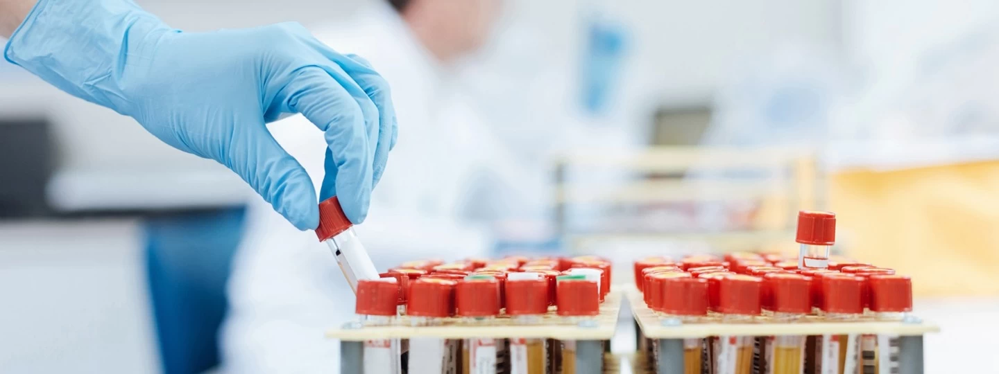 SGPT Blood Test: Normal Values, High Levels and Liver Health Insights