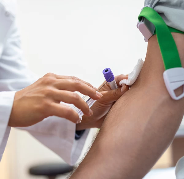 Erythrocyte Sedimentation Rate (ESR) Test: Normal Range and Health Implications