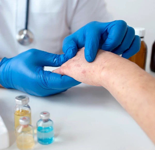 Lupus Symptoms in Women and Men: Causes, Diagnosis, and Treatment Approach