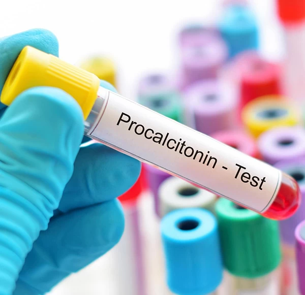 Procalcitonin Test: Detecting Severe Bacterial Infection Early