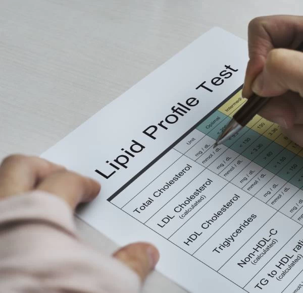 Answering Frequently Asked Questions About the Lipid Profile Test