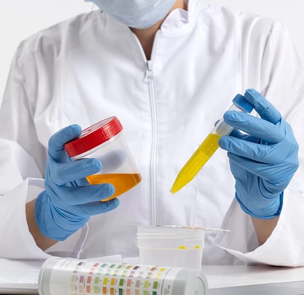 Amylase and Lipase Tests for Detecting Pancreatic Disorders