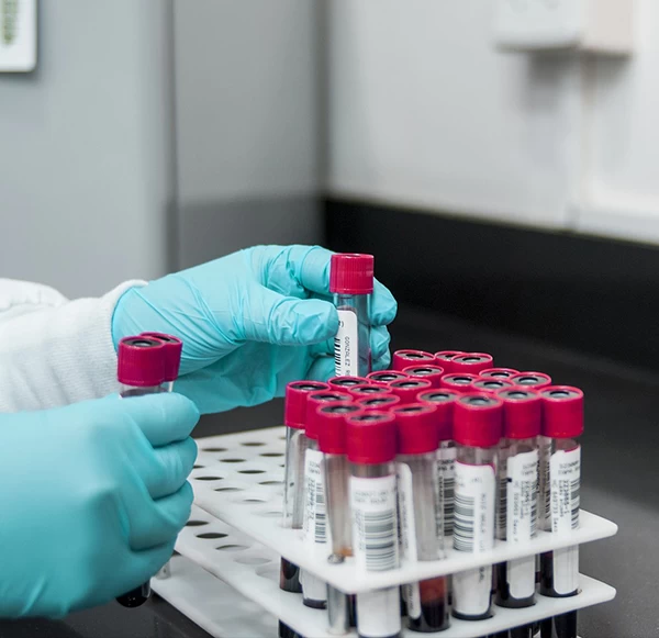 Breaking down the Amylase test: Purpose, Procedure & Results