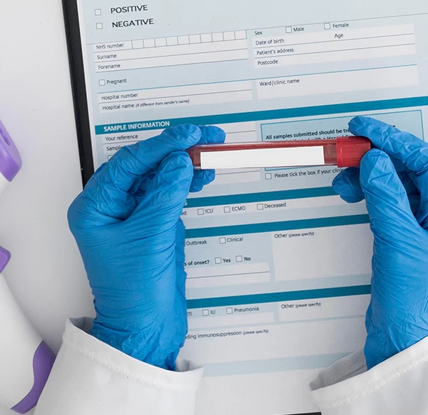 Anti HCV Ab Test: Purpose, Procedure, Results, and Importance for Liver Health