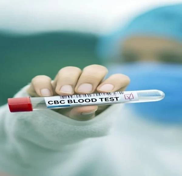 CBC Blood Test In Delhi: Essential Information And Where To Get Tested