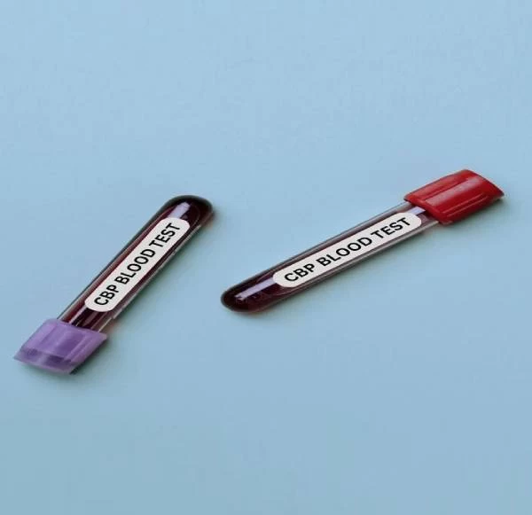 Complete Blood Diagnosis Services: Accuracy You Can Trust