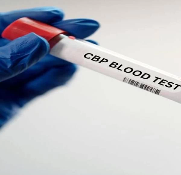 What Is A CBP Test And Why You Should Choose Mahajan Imaging & Labs For It