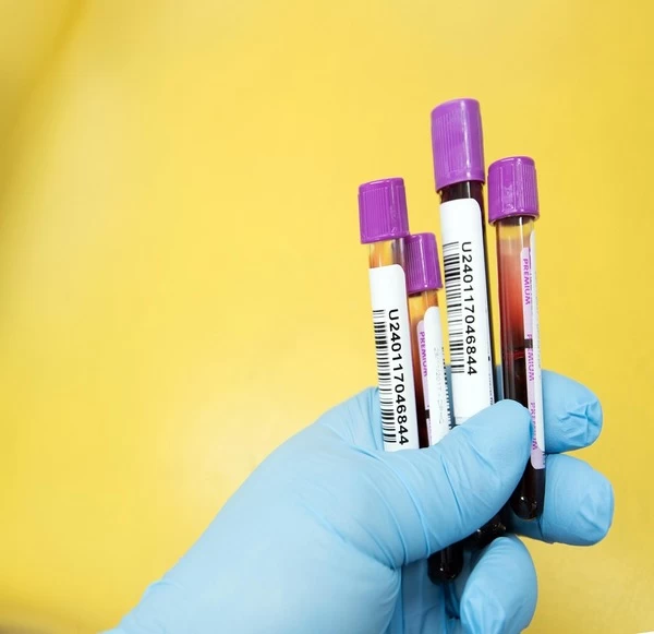 Chikungunya: Symptoms, Risks, and Accurate Diagnostics