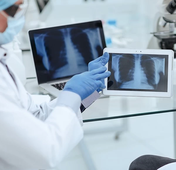 CT Scan vs X-Ray: Key Differences, Advantages & Disadvantages