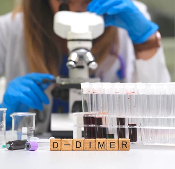 D-Dimer Test: Ruling Out Clots and Vascular Conditions