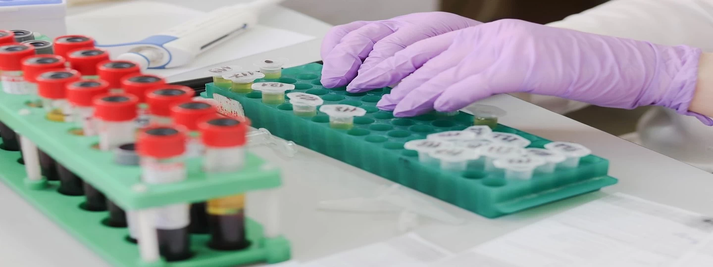 Beyond the numbers: Unlocking the secrets of your Lipid Profile Test