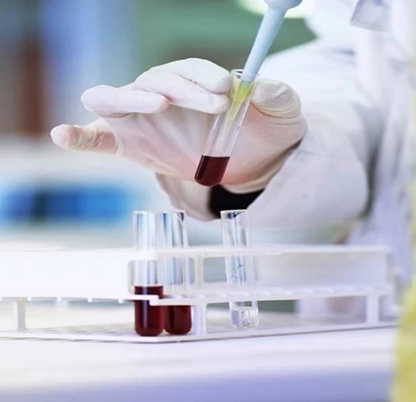 The Importance Of Regular LFT And RFT Tests