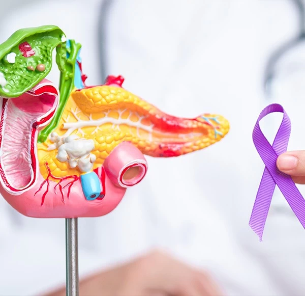 Pancreatic Cancer Screening: Tests That Can Save Lives