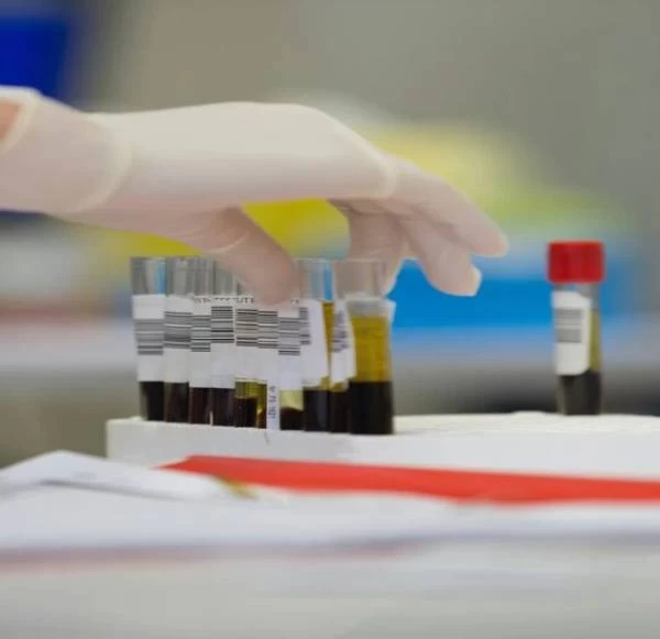 Monitoring SGOT to build a stronger and healthier you