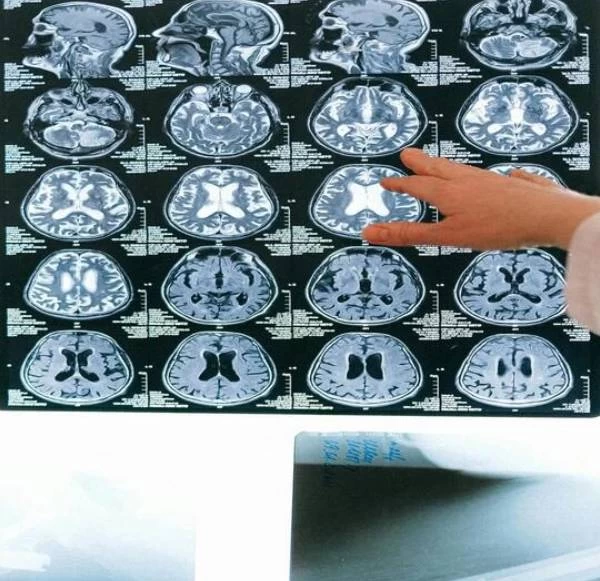 Managing Sports Injuries: How Mahajan Imaging & Labs Provides Accurate Diagnosis