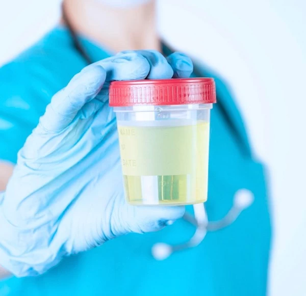 Stool Test: Diagnosing Digestive and Gut Health Problems