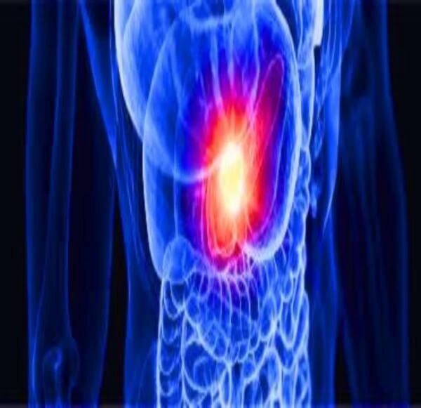 Beyond the Diagnosis: Exploring Pancreatic Cancer’s Causes, and Signs