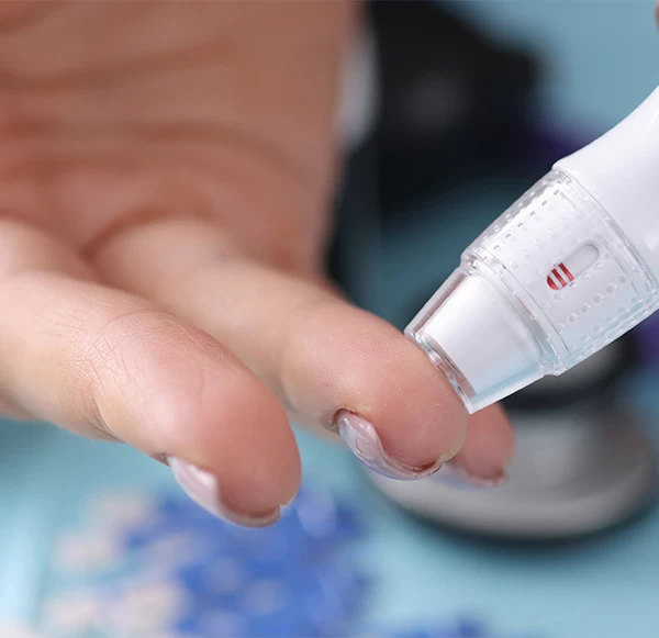 HbA1c Blood Test: Normal Range, Procedure, Results & Diabetes Control Guide