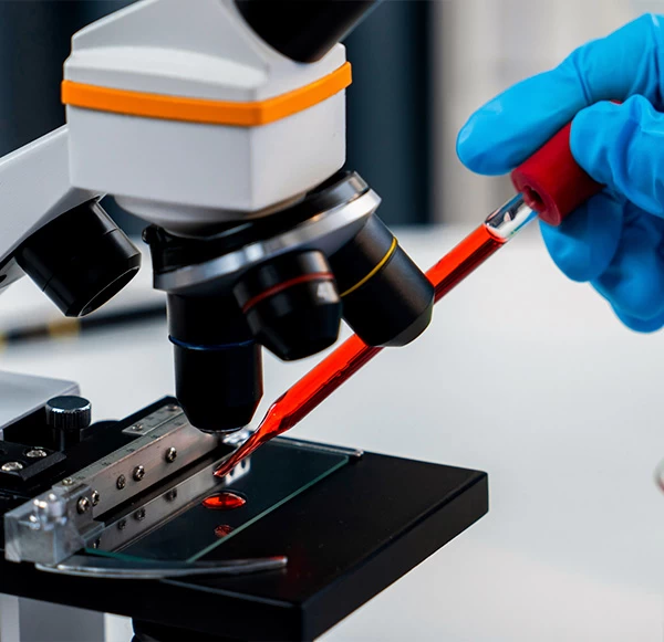 Why Choosing the Right Pathology Lab Matters for Your Health
