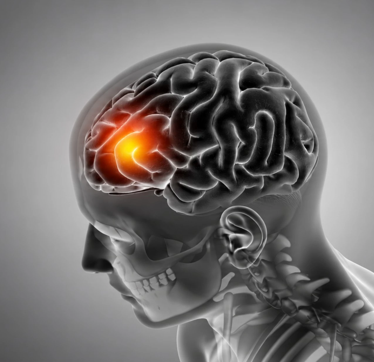 World Stroke Day: Recognising Warning Signs and Risk Factors Early