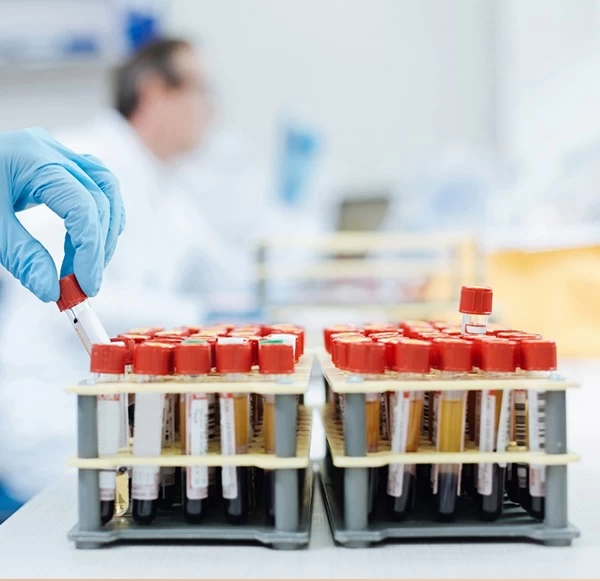 SGPT Blood Test: Normal Values, High Levels and Liver Health Insights