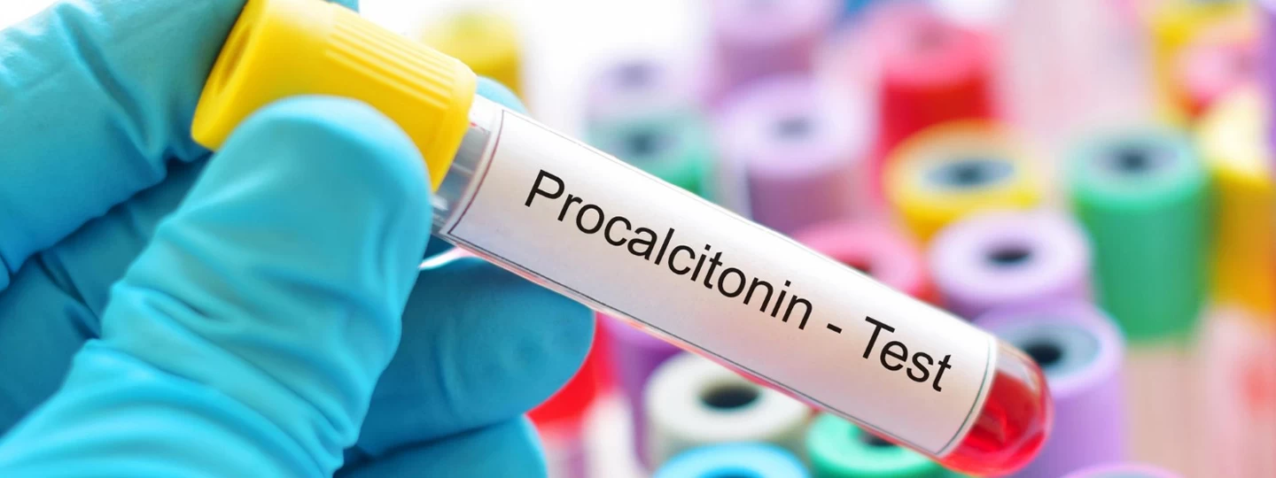 Procalcitonin Test: Detecting Severe Bacterial Infection Early