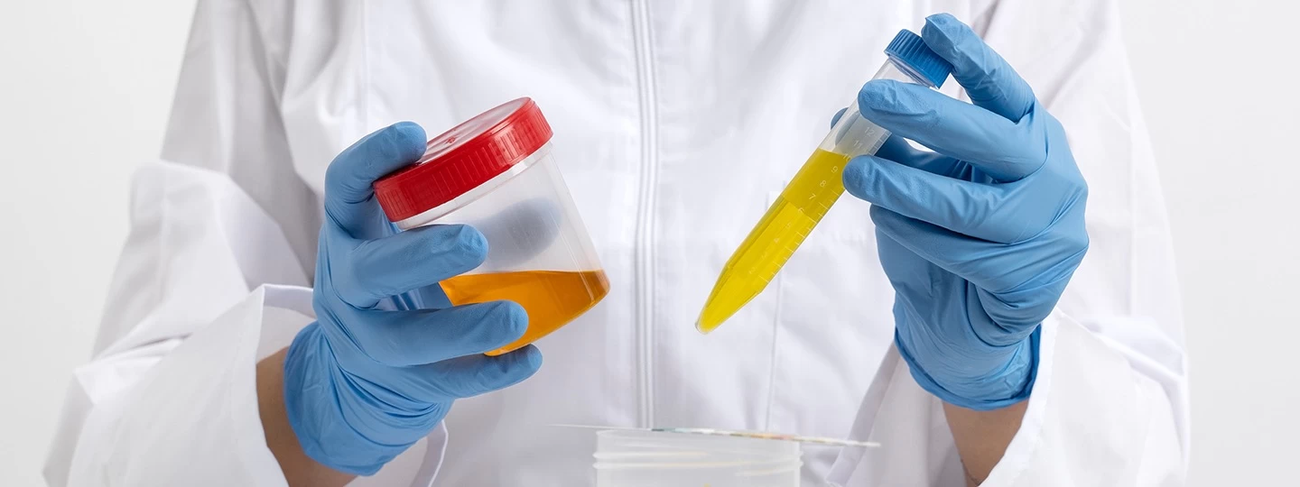 Amylase and Lipase Tests for Detecting Pancreatic Disorders