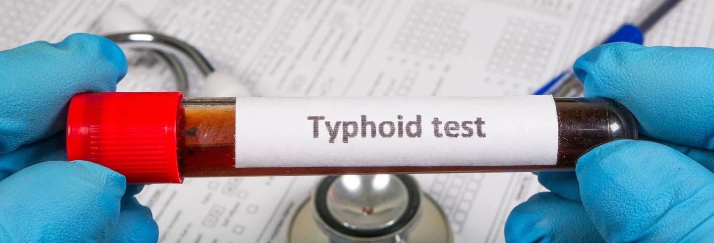 Typhoid Blood Test: Accuracy, Procedure & Where to Get Tested
