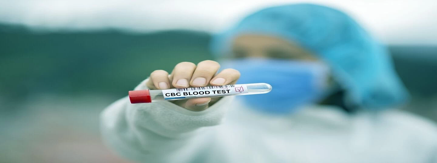 CBC Blood Test In Delhi: Essential Information And Where To Get Tested