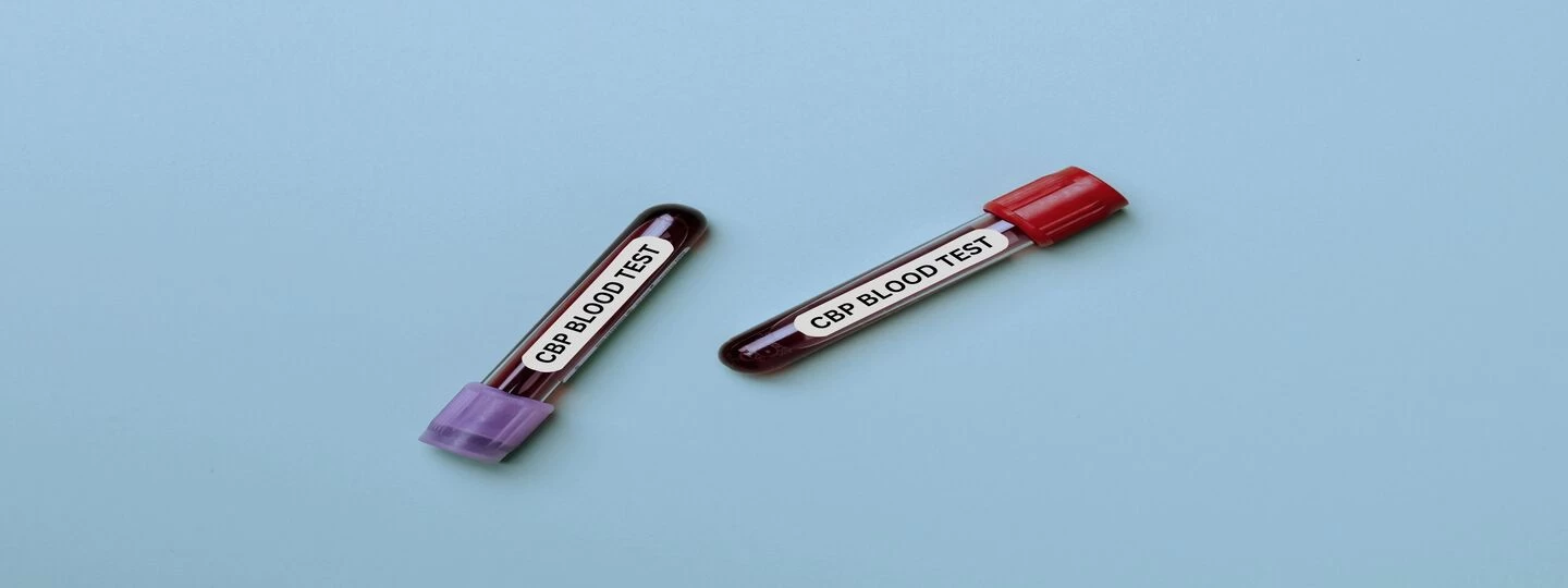 Complete Blood Diagnosis Services: Accuracy You Can Trust
