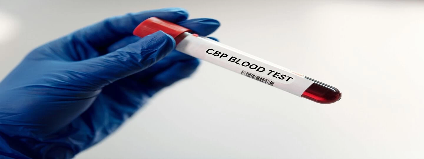 What Is A CBP Test And Why You Should Choose Mahajan Imaging & Labs For It