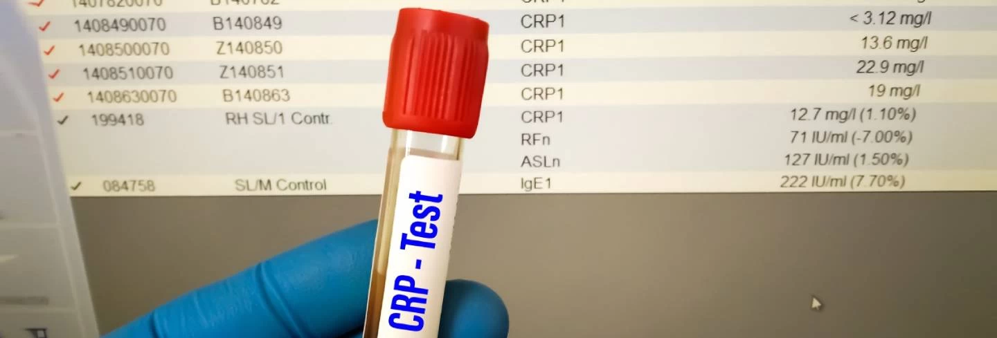 CRP Test: Decoding the Normal Range