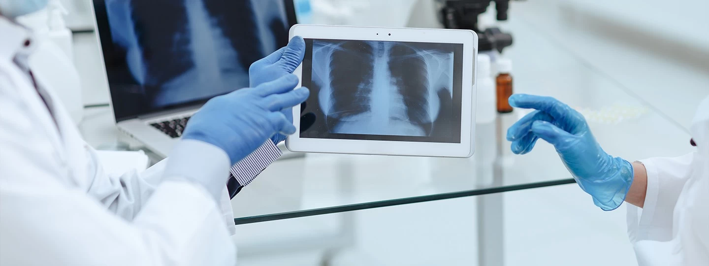 CT Scan vs X-Ray: Key Differences, Advantages & Disadvantages