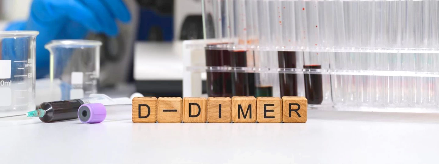 D-Dimer Test: Ruling Out Clots and Vascular Conditions