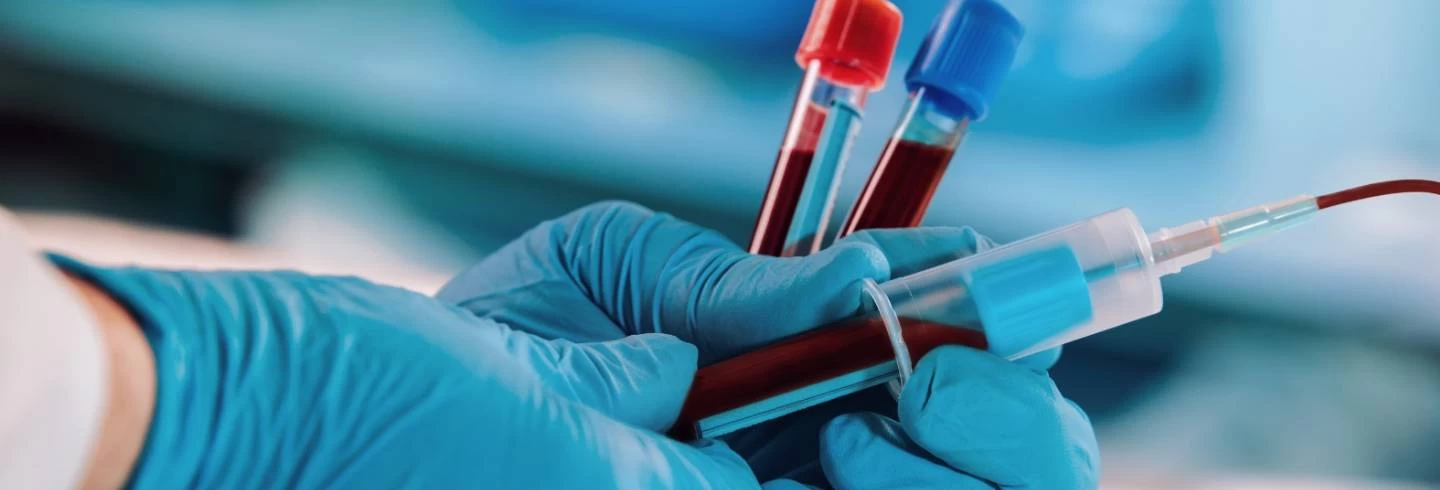 Folic Acid Test: Know Why It's Crucial for Your Health