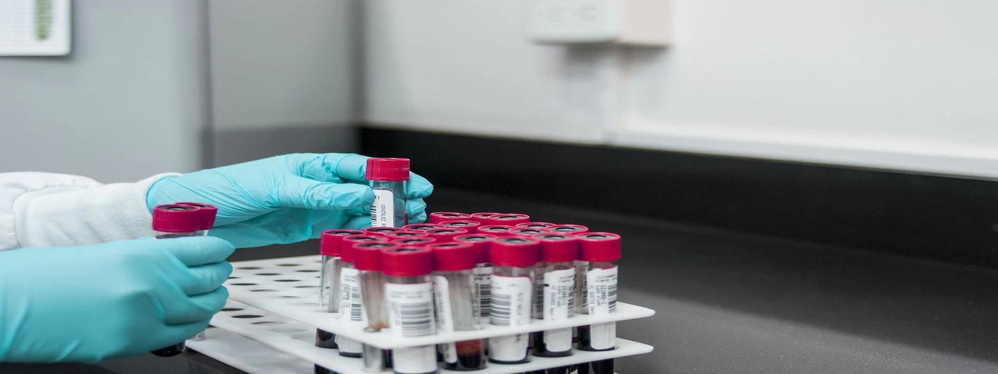 Breaking down the Amylase test: Purpose, Procedure & Results