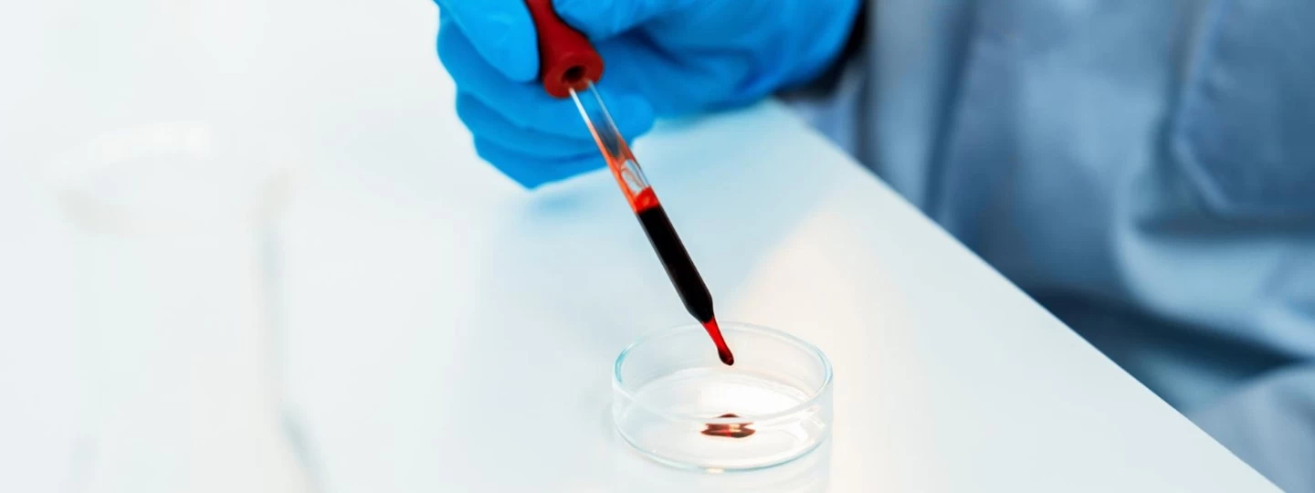 Scleroderma Blood Tests: ANA and Autoimmune Markers Explained