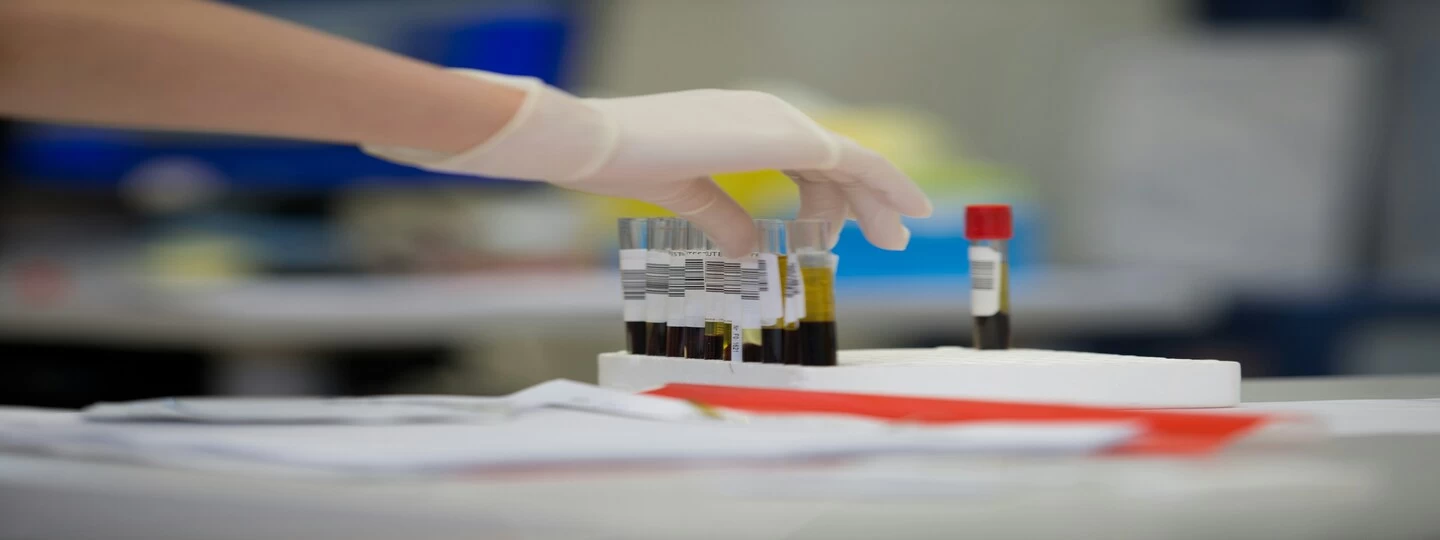 Monitoring SGOT to build a stronger and healthier you