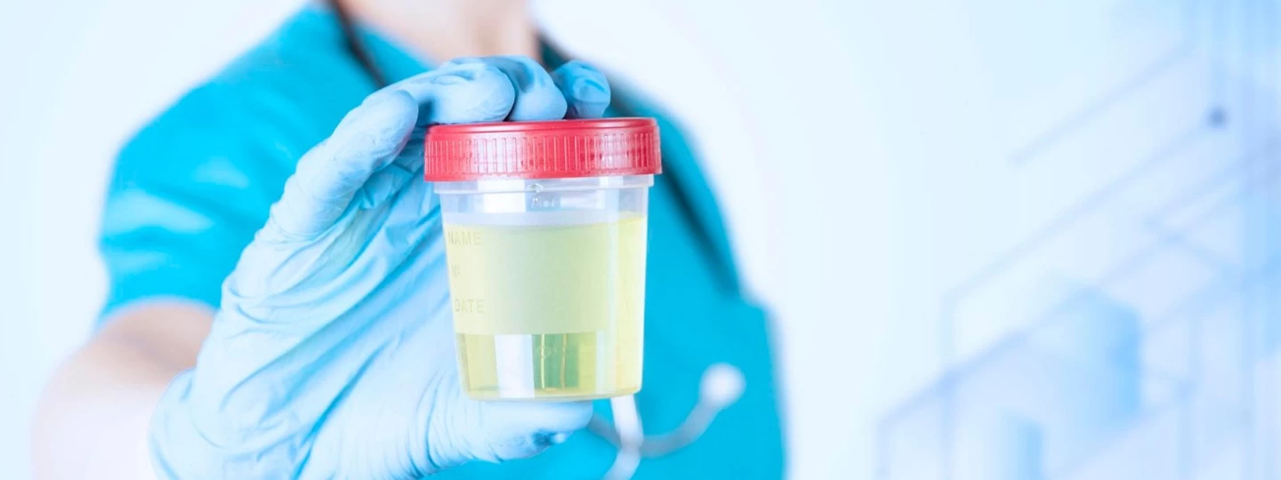 Stool Test: Diagnosing Digestive and Gut Health Problems