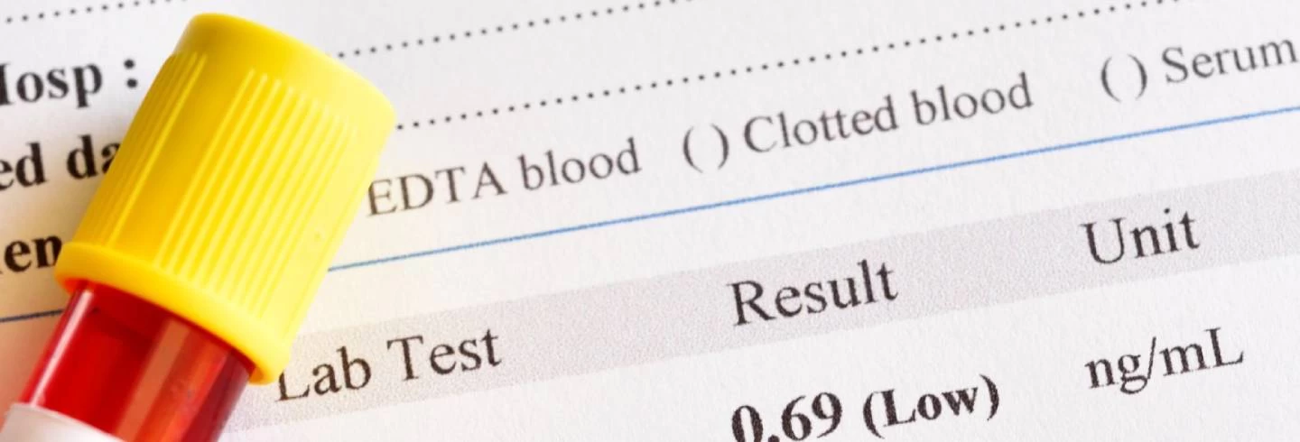 Testosterone Test Explained: Process, Levels & When You Need It