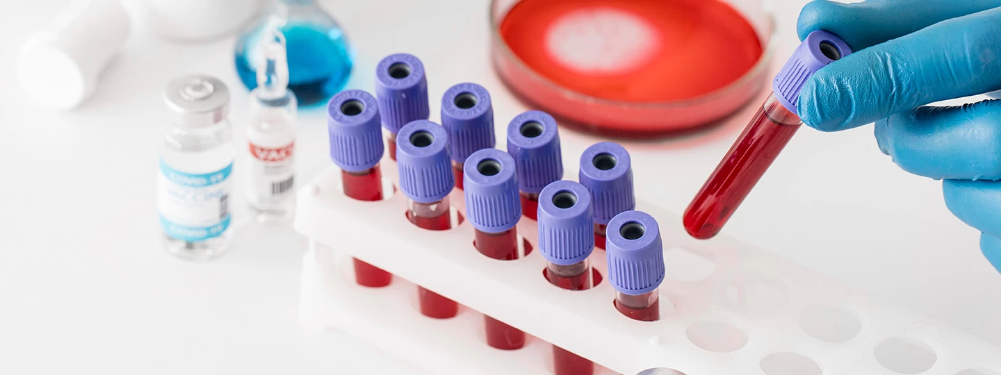 What Is the Hemogram Test Price at Mahajan Imaging & Labs, and What Affects It?