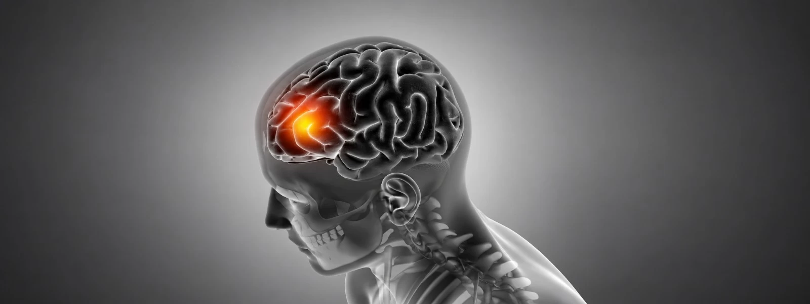 World Stroke Day: Recognising Warning Signs and Risk Factors Early